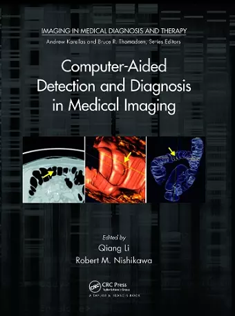 Computer-Aided Detection and Diagnosis in Medical Imaging cover