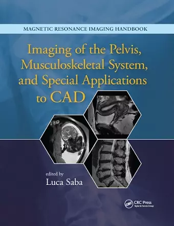 Imaging of the Pelvis, Musculoskeletal System, and Special Applications to CAD cover