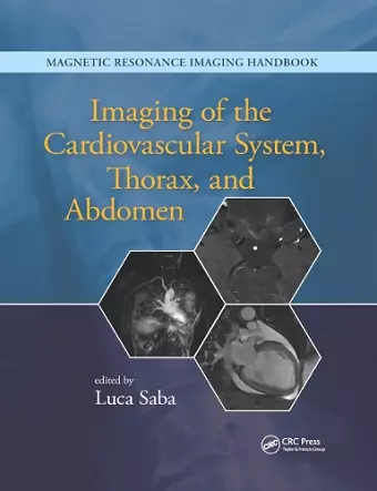 Imaging of the Cardiovascular System, Thorax, and Abdomen cover