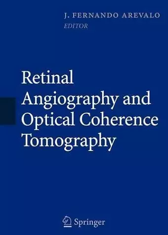 Retinal Angiography and Optical Coherence Tomography cover