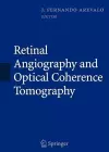 Retinal Angiography and Optical Coherence Tomography cover