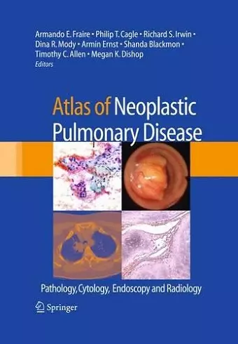 Atlas of Neoplastic Pulmonary Disease cover
