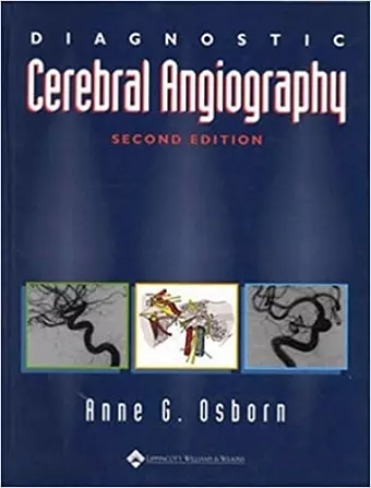 Diagnostic Cerebral Angiography cover