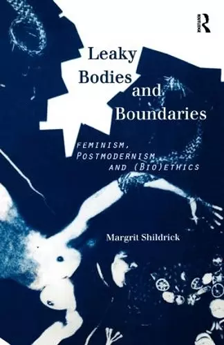 Leaky Bodies and Boundaries cover