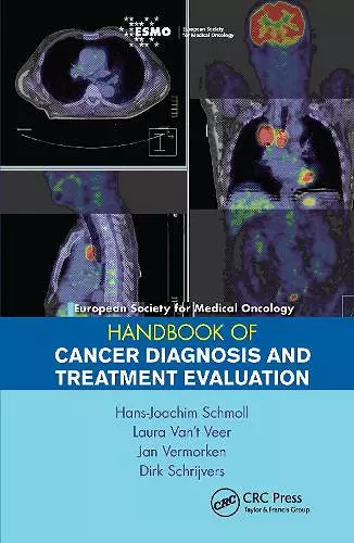 ESMO Handbook of Cancer Diagnosis and Treatment Evaluation cover