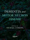 Dementia and Motor Neuron Disease cover
