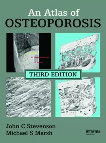 An Atlas of Osteoporosis cover