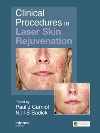 Clinical Procedures in Laser Skin Rejuvenation cover