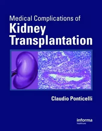 Medical Complications of Kidney Transplantation cover