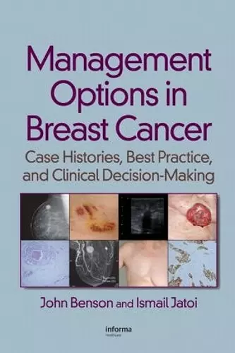 Management Options in Breast Cancer cover