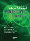 Treatment Methods for Early and Advanced Prostate Cancer cover