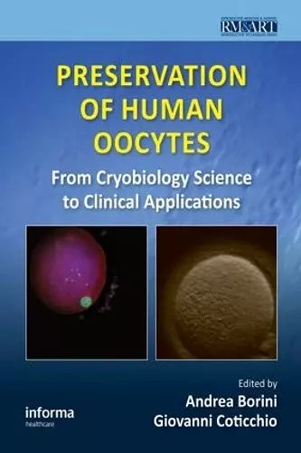 Preservation of Human Oocytes cover