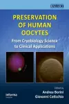 Preservation of Human Oocytes cover