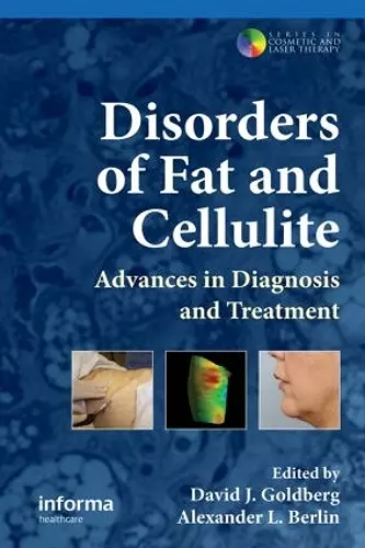 Disorders of Fat and Cellulite cover