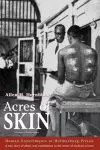 Acres of Skin cover