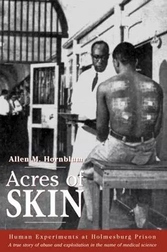 Acres of Skin cover