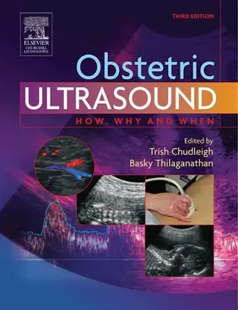 Obstetric Ultrasound cover