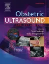 Obstetric Ultrasound cover