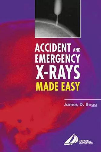 Accident and Emergency X-Rays Made Easy cover