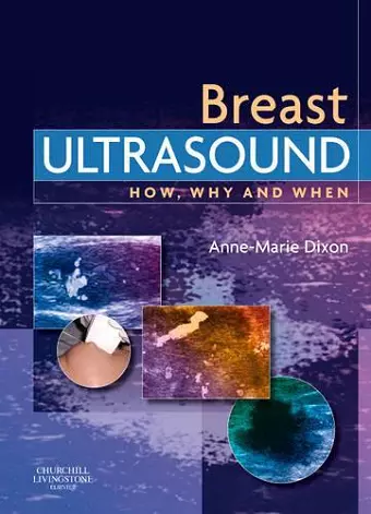 Breast Ultrasound cover