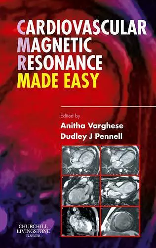 Cardiovascular Magnetic Resonance Made Easy cover