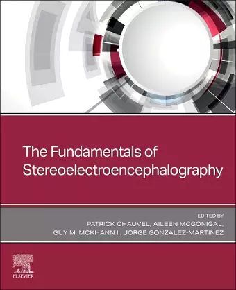 The Fundamentals of Stereoelectroencephalography cover