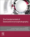 The Fundamentals of Stereoelectroencephalography cover