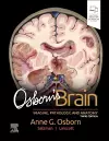 Osborn's Brain cover