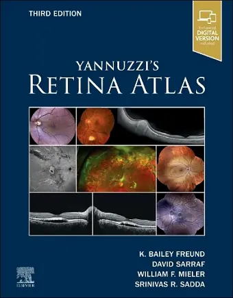 Yannuzzi's Retina Atlas cover