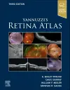 Yannuzzi's Retina Atlas cover