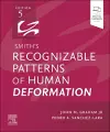 Smith's Recognizable Patterns of Human Deformation cover