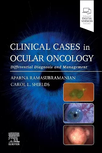 Clinical Cases in Ocular Oncology cover