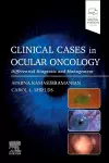 Clinical Cases in Ocular Oncology cover