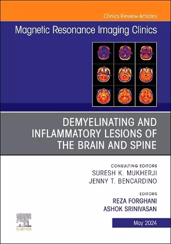 Demyelinating and Inflammatory Lesions of the Brain and Spine, An Issue of Magnetic Resonance Imaging Clinics of North America cover