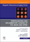 Demyelinating and Inflammatory Lesions of the Brain and Spine, An Issue of Magnetic Resonance Imaging Clinics of North America cover