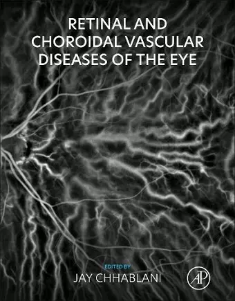 Retinal and Choroidal Vascular Diseases of the Eye cover