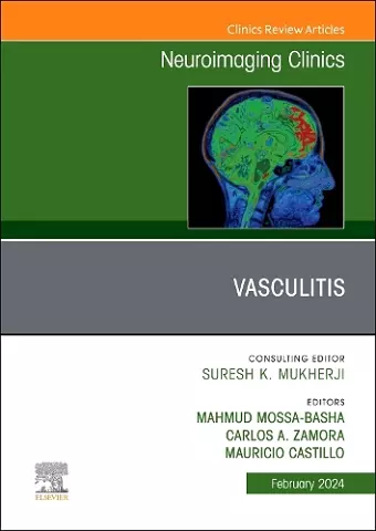 Vasculitis, An Issue of Neuroimaging Clinics of North America cover