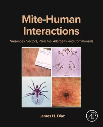 Mite-Human Interactions cover