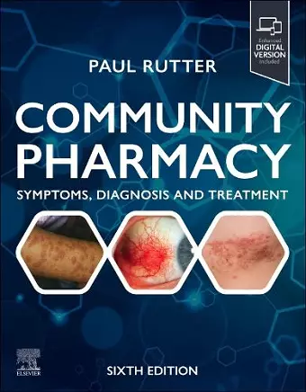 Community Pharmacy: Symptoms, Diagnosis and Treatment cover