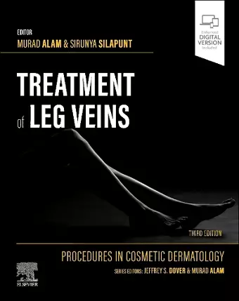 Procedures in Cosmetic Dermatology Series: Treatment of Leg Veins cover