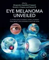 Eye Melanoma Unveiled cover
