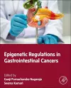 Epigenetic Regulations in Gastrointestinal Cancers cover