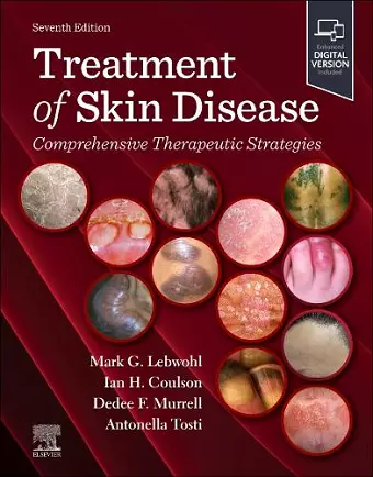 Treatment of Skin Disease: Comprehensive Therapeutic Strategies cover