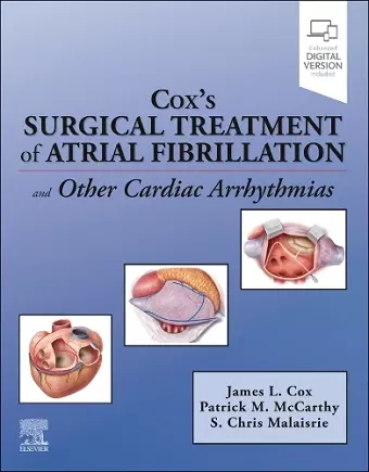 Cox's Surgical Treatment of Atrial Fibrillation cover
