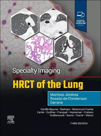 Specialty Imaging: HRCT of the Lung cover