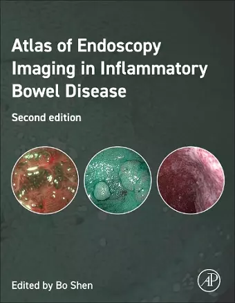 Atlas of Endoscopy Imaging in Inflammatory Bowel Disease cover