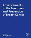 Advancements in the Treatment and Prevention of Breast Cancer cover