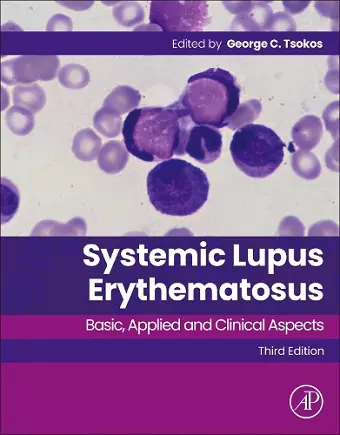 Systemic Lupus Erythematosus cover