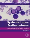 Systemic Lupus Erythematosus cover