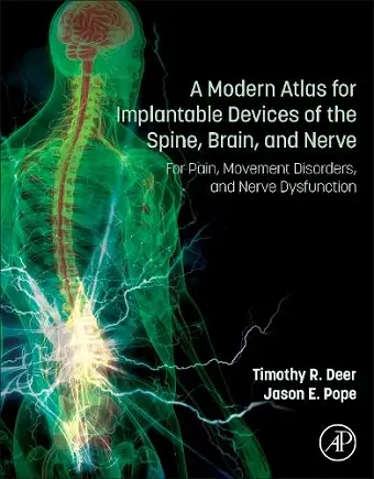 A Modern Atlas for Implantable Devices of the Spine, Brain, and Nerve cover